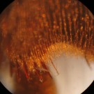 Erdhummel unter dem Mikroskop. 
Zu sehen ist der Übergang von Metatarsus zu Tarsus am Hinterbein.
Hochgeladen am 14.09.2014 von Bulli